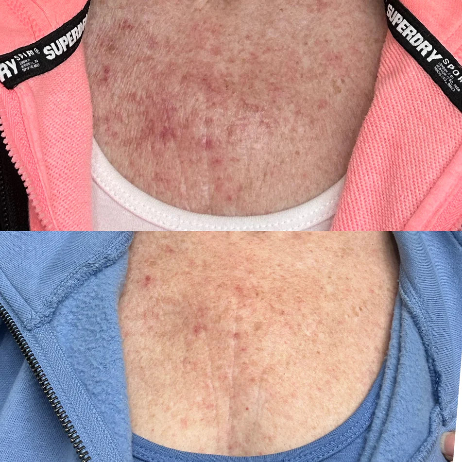 Taladerma Biome Restore Oil